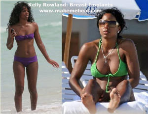 kelly-rowland-breast-implants.jpg